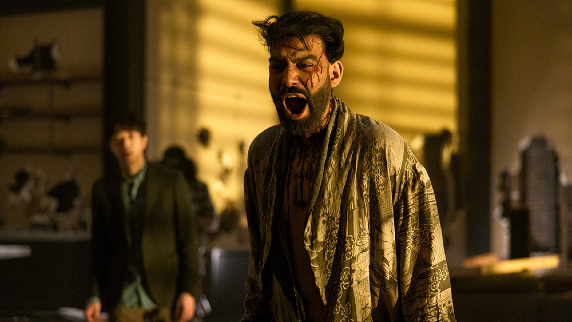 A man with scratches on his face screams, while another man in the background looks on.